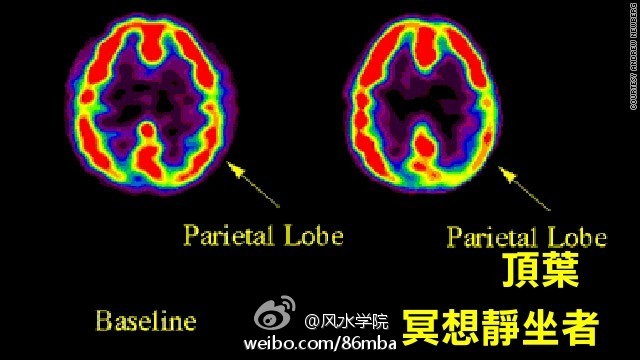 科学新知：冥想静坐可以改变大脑